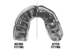 Protège-dents Simple, Thermoformable - OPRO X UFC Self-fit, OPRO -Martiaux Boutique protege dents simple thermoformable self fit v2 opro 3