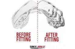 Protège-dents Simple, Thermoformable - Translucide, Safe Jawz -Martiaux Boutique protege dents simple thermoformable translucide safe jaws 3